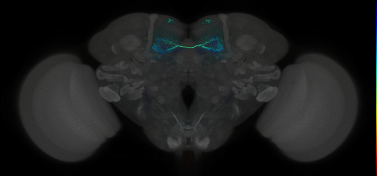 JRC_MB188B_Brain_2014_20121018_34_C1_20x