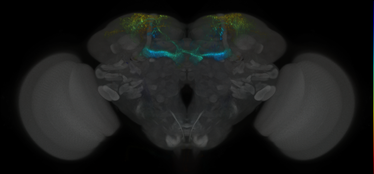 JRC_MB194B_Brain_2014_20121018_34_F3_20x