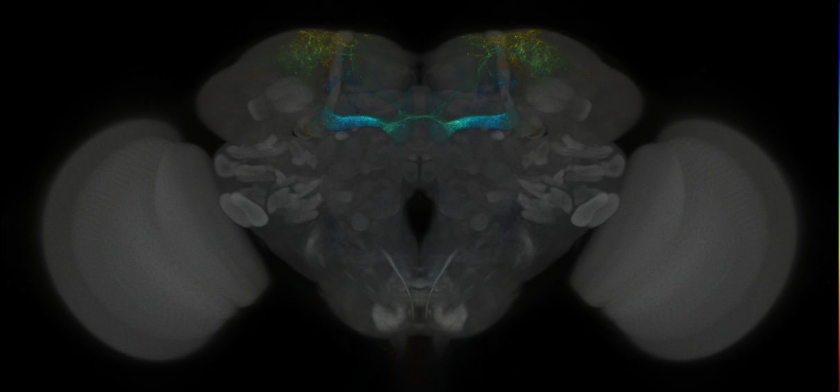 JRC_MB194B_Brain_2014_20121018_34_F4_20x