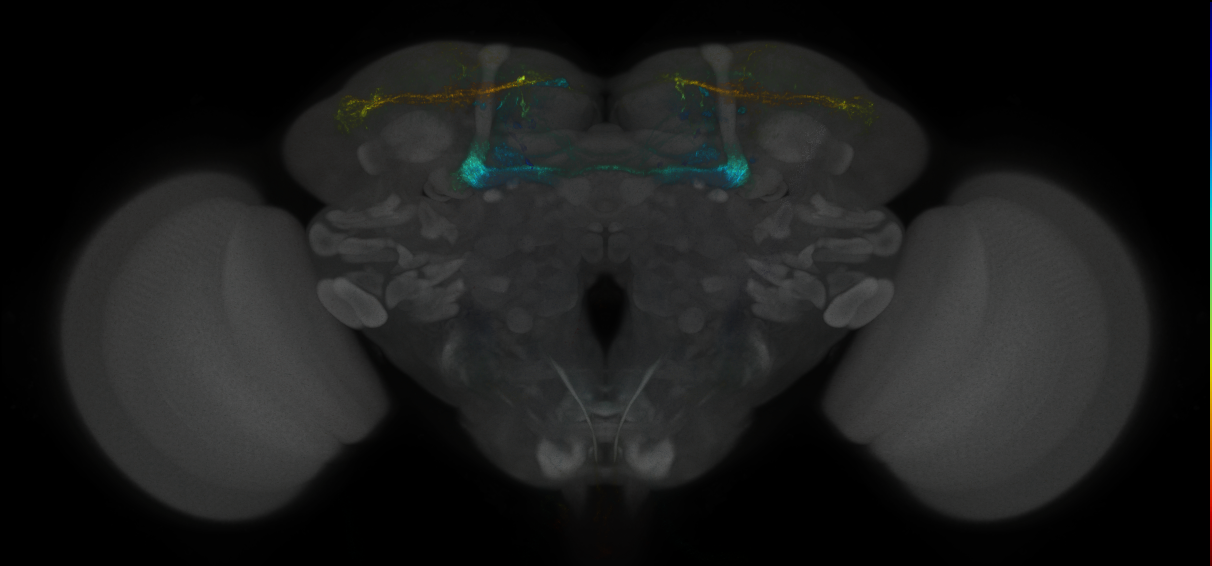 JRC_MB043B_Brain_2014_20121018_34_H5_20x