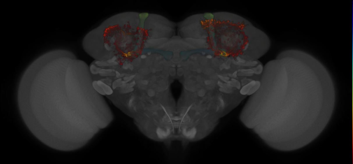 JRC_MB477B_Brain_2014_20121213_33_D1_20x