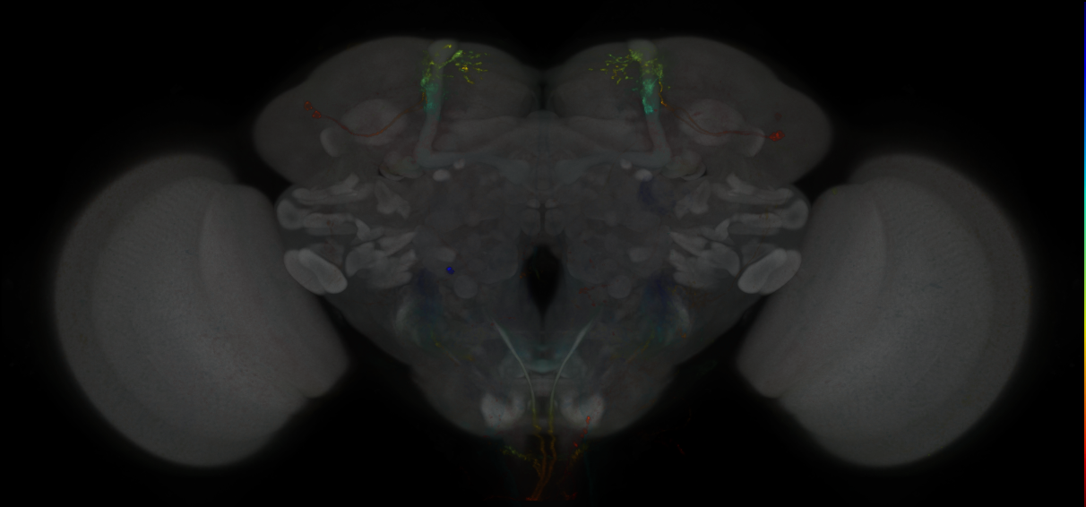 JRC_MB062B_Brain_2014_20130115_31_B1_20x
