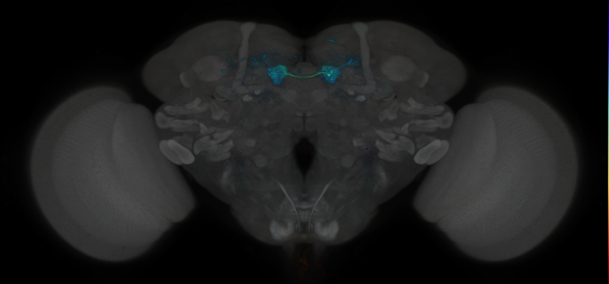 JRC_MB312C_Brain_2014_20130116_31_H1_20x