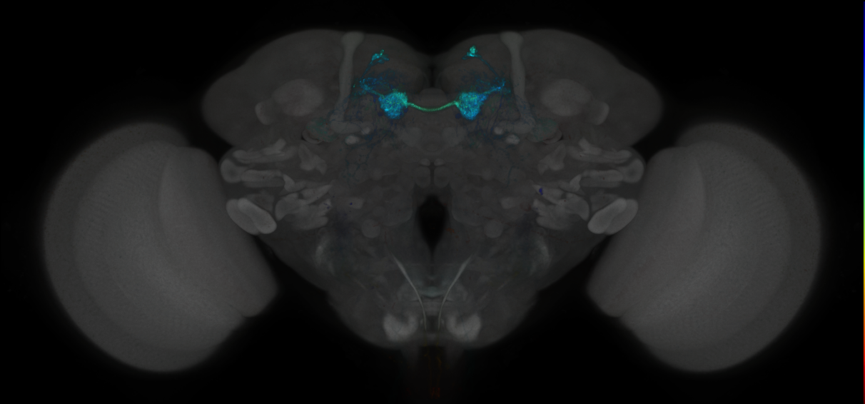 JRC_MB312C_Brain_2014_20130116_31_H2_20x