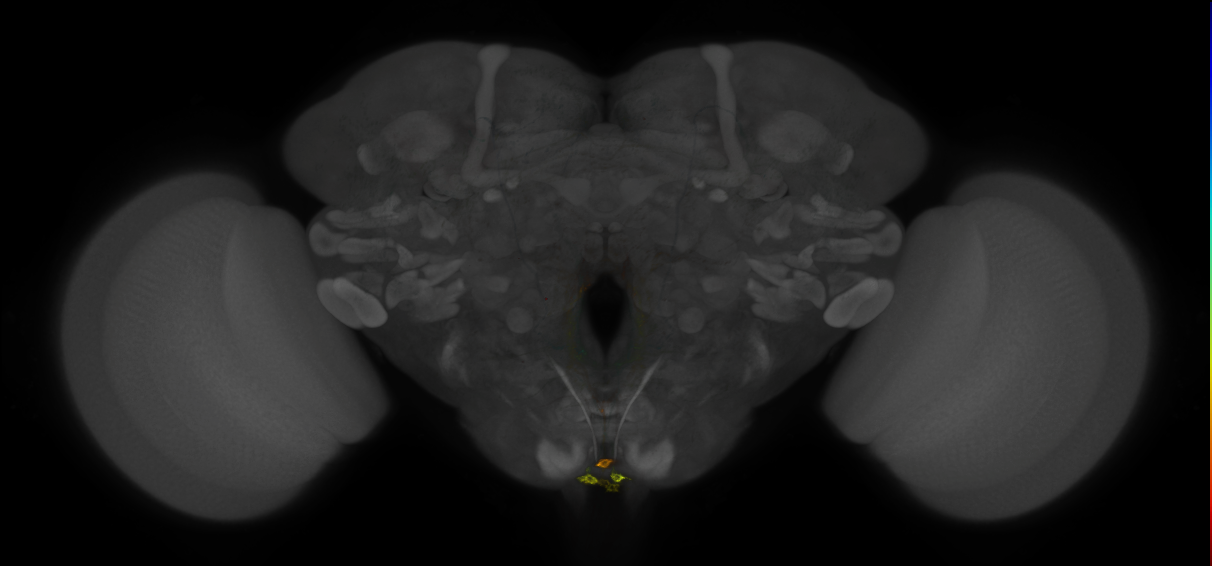JRC_MB113C_Brain_2014_20121208_31_C1_20x