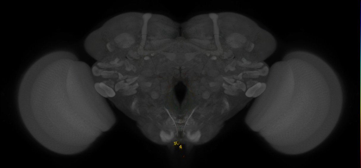 JRC_MB113C_Brain_2014_20121208_31_C4_20x