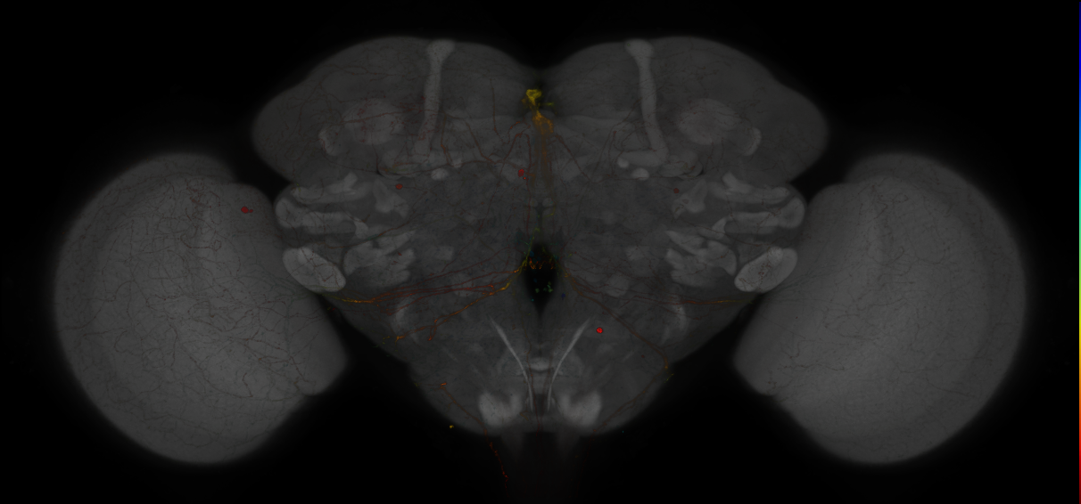 JRC_MB013B_Brain_2014_20121208_31_E1_20x