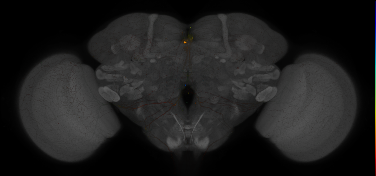 JRC_MB013B_Brain_2014_20121208_31_E2_20x