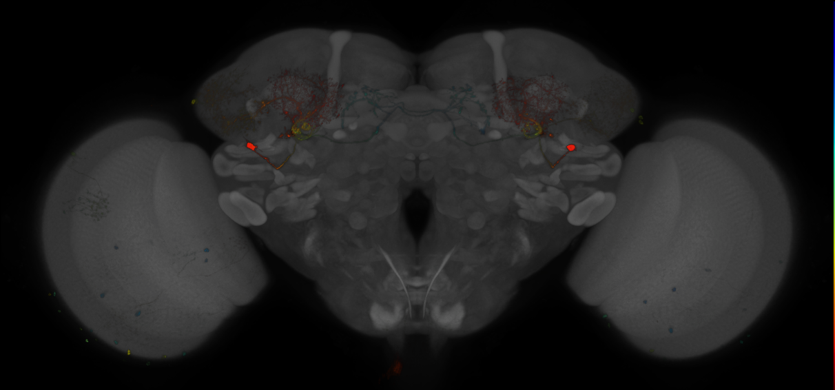 JRC_MB242A_Brain_2014_20121208_31_H2_20x