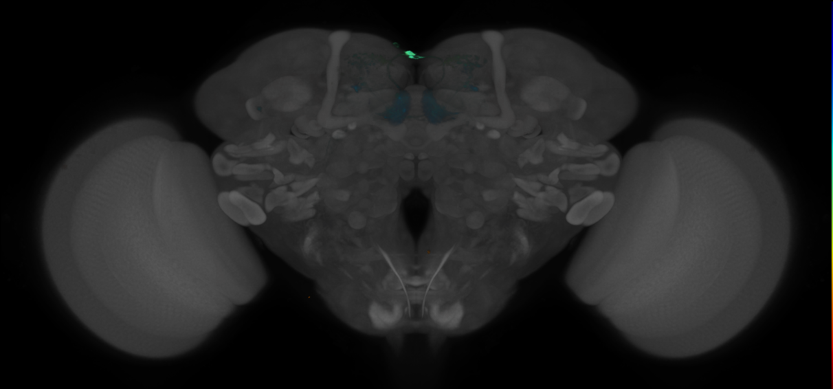 JRC_MB210B_Brain_2014_20121210_31_B6_20x