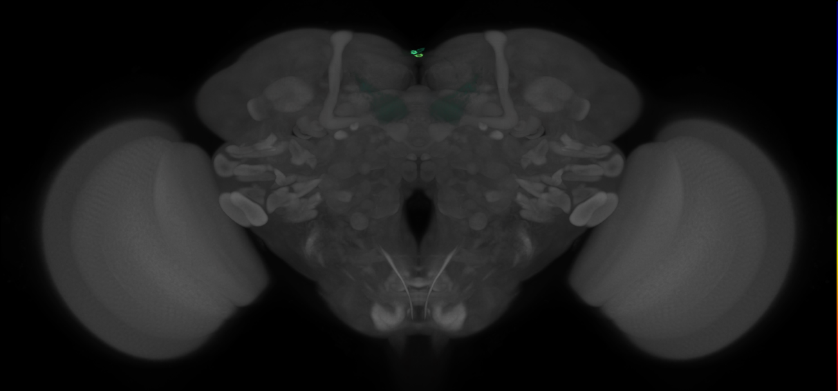 JRC_MB002B_Brain_2014_20121210_31_C2_20x