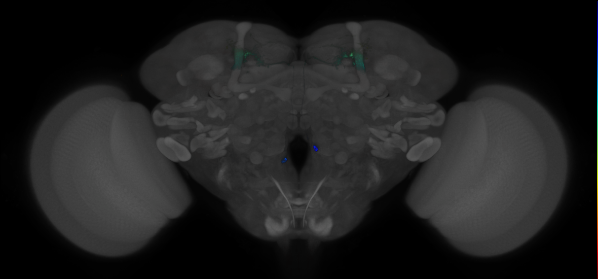 JRC_MB018B_Brain_2014_20121210_31_H1_20x