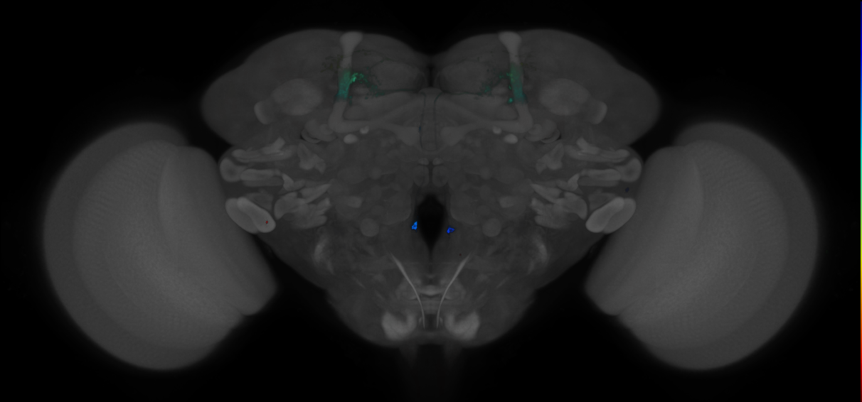 JRC_MB018B_Brain_2014_20121210_31_H2_20x