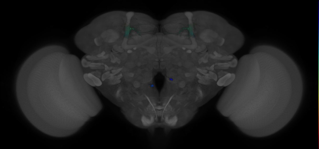 JRC_MB018B_Brain_2014_20121210_31_H3_20x