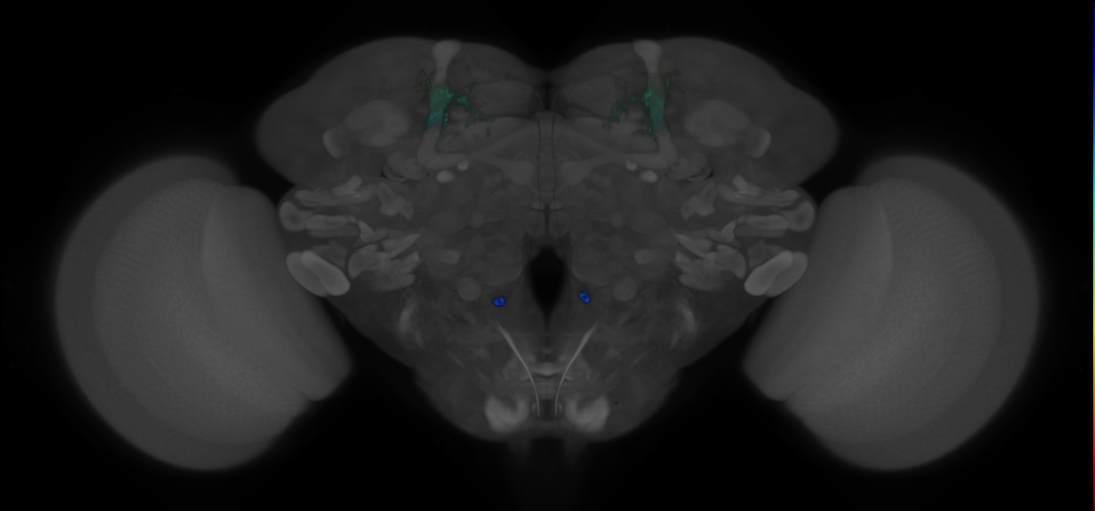 JRC_MB018B_Brain_2014_20121210_31_H4_20x