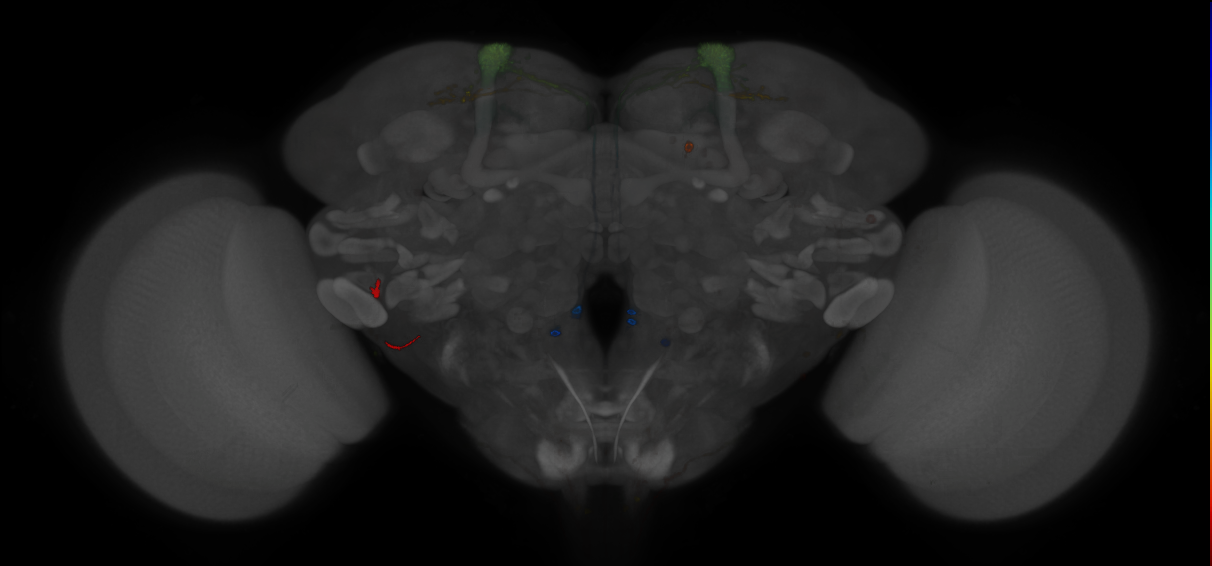 JRC_MB093C_Brain_2014_20121210_31_I1_20x