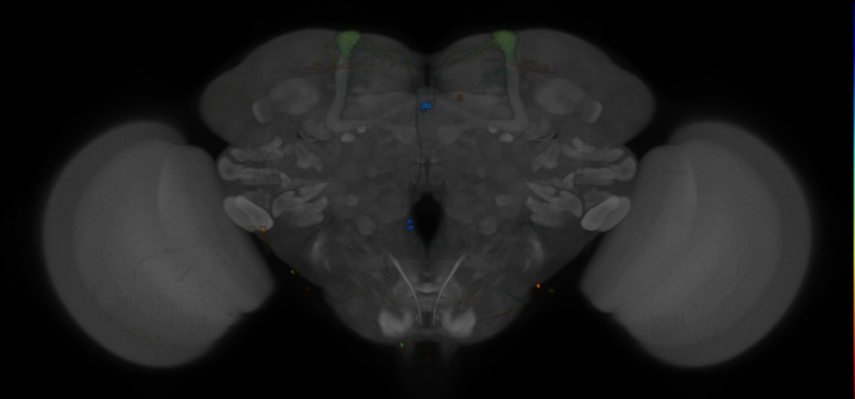 JRC_MB093C_Brain_2014_20121210_31_I4_20x