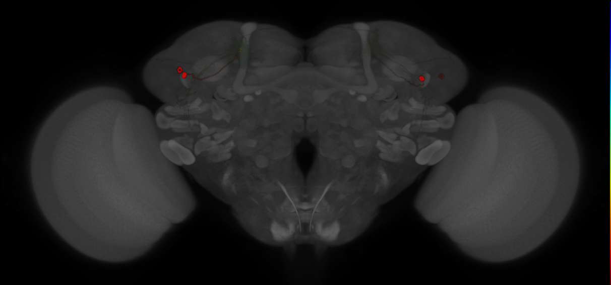 JRC_MB549C_Brain_2014_20121210_32_D5_20x