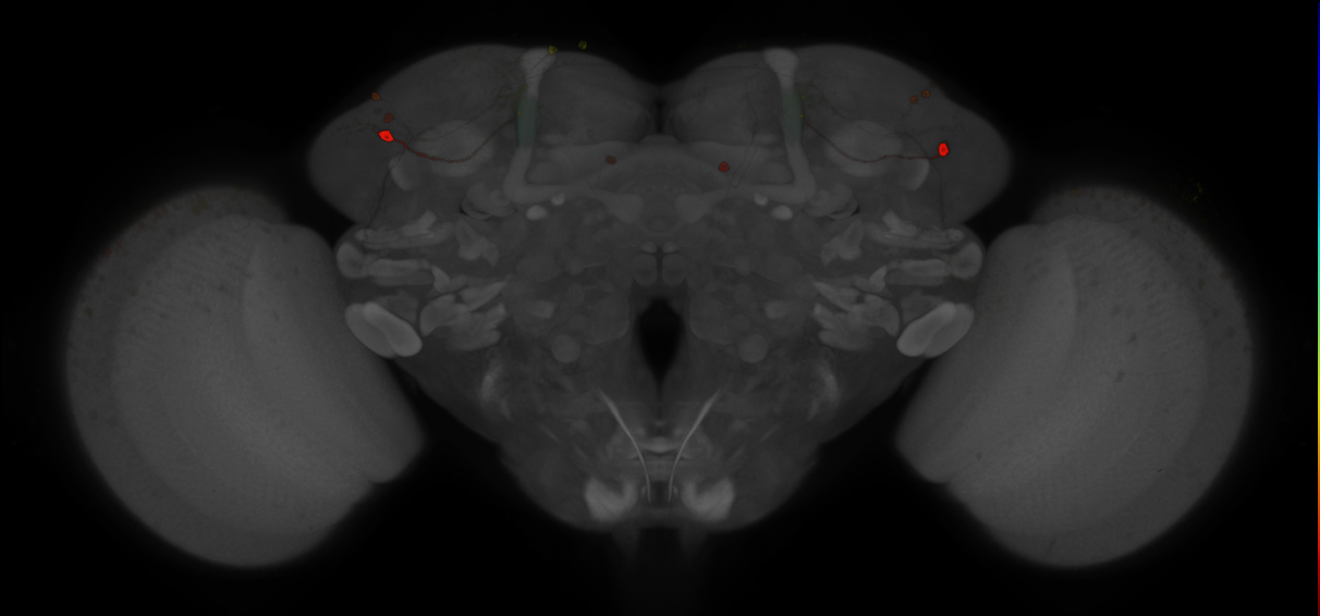 JRC_MB080C_Brain_2014_20121210_32_F3_20x