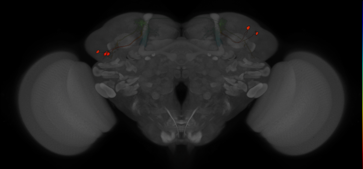 JRC_MB543B_Brain_2014_20121210_32_H4_20x
