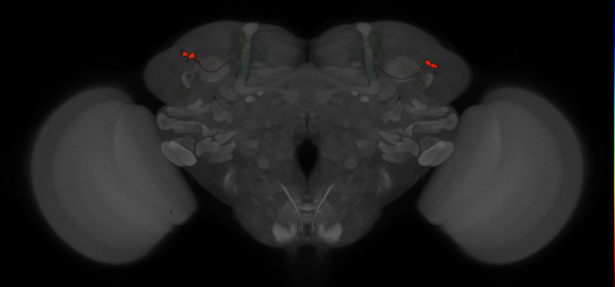 JRC_MB543B_Brain_2014_20121210_32_H5_20x