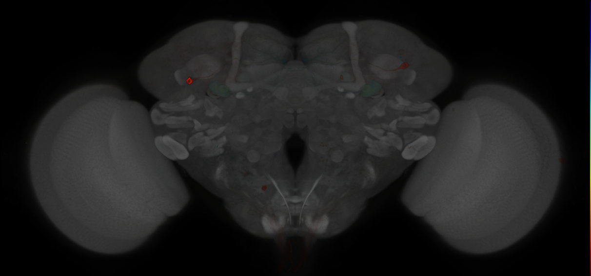 JRC_MB438B_Brain_2014_20121210_33_C2_20x
