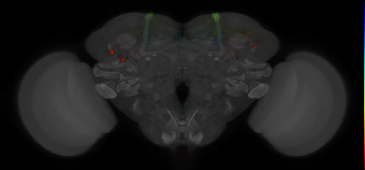 JRC_MB065B_Brain_2014_20121210_33_H2_20x