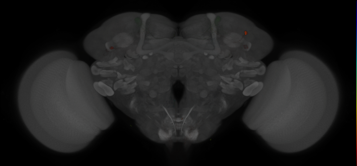 JRC_MB304B_Brain_2014_20121210_33_J1_20x