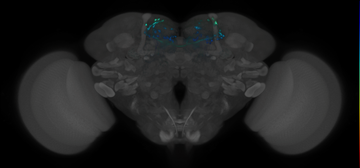 JRC_MB196B_Brain_2014_20121212_31_C2_20x