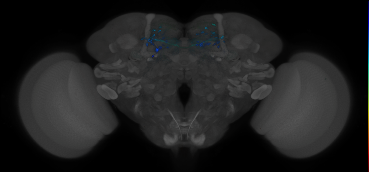 JRC_MB196B_Brain_2014_20121212_31_C4_20x