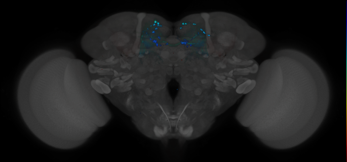 JRC_MB188B_Brain_2014_20121212_31_E2_20x