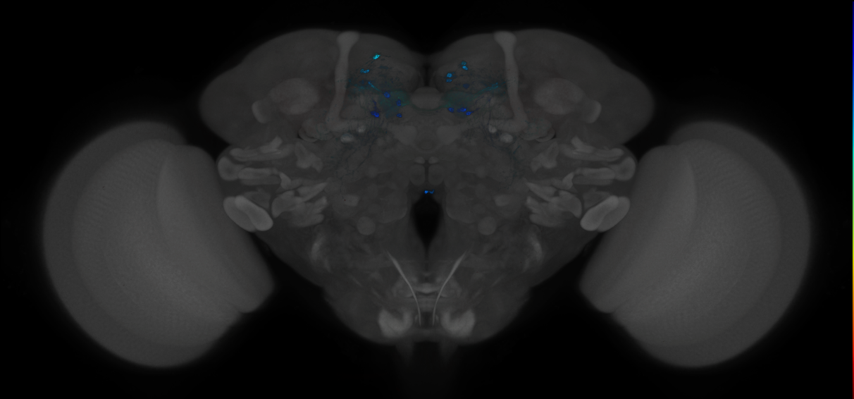 JRC_MB312B_Brain_2014_20121212_31_H4_20x