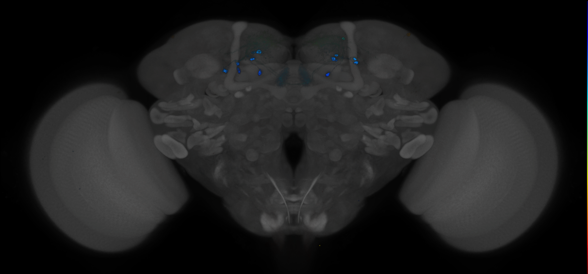 JRC_MB315C_Brain_2014_20121212_31_J3_20x