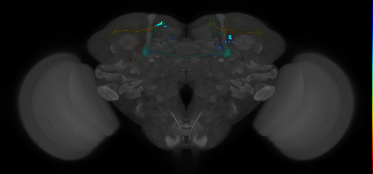 JRC_MB043B_Brain_2014_20121212_32_A3_20x