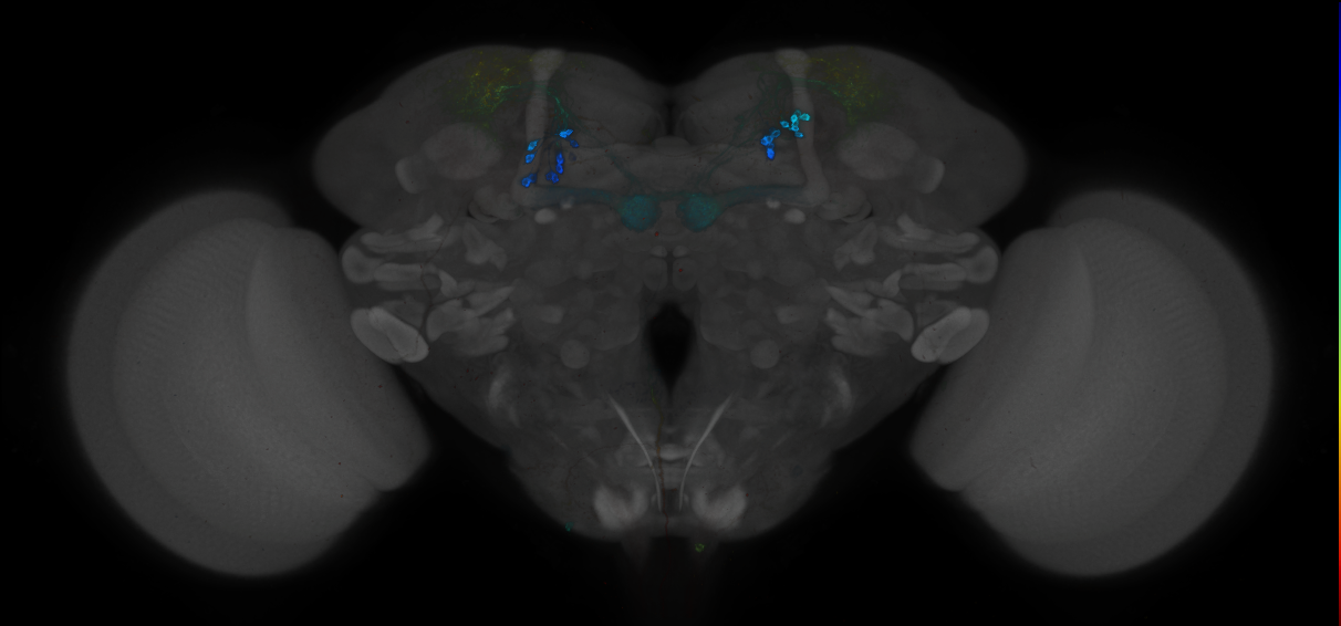 JRC_MB213B_Brain_2014_20121212_32_B1_20x