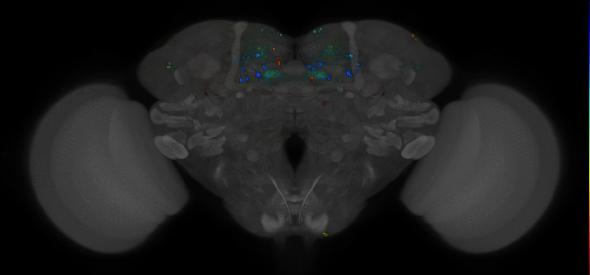 JRC_MB047B_Brain_2014_20121212_32_C1_20x