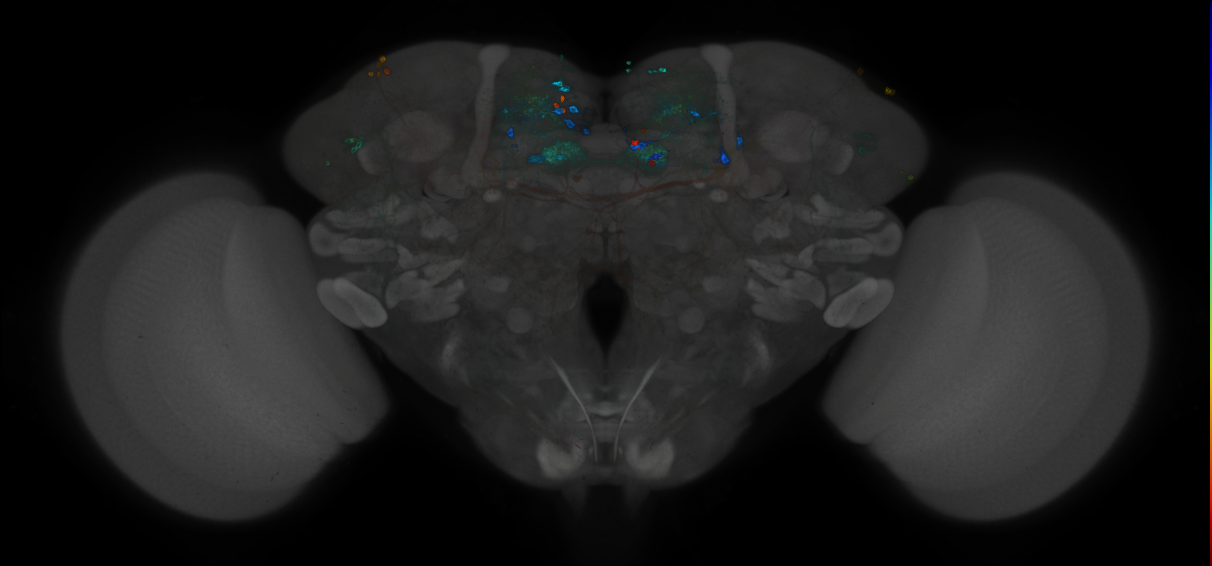 JRC_MB047B_Brain_2014_20121212_32_C3_20x