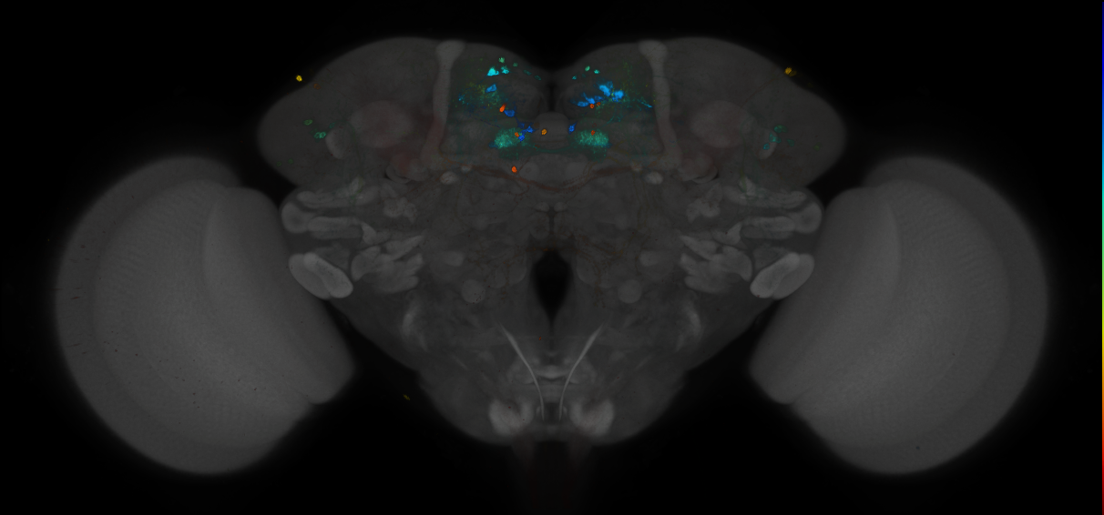 JRC_MB047B_Brain_2014_20121212_32_C4_20x