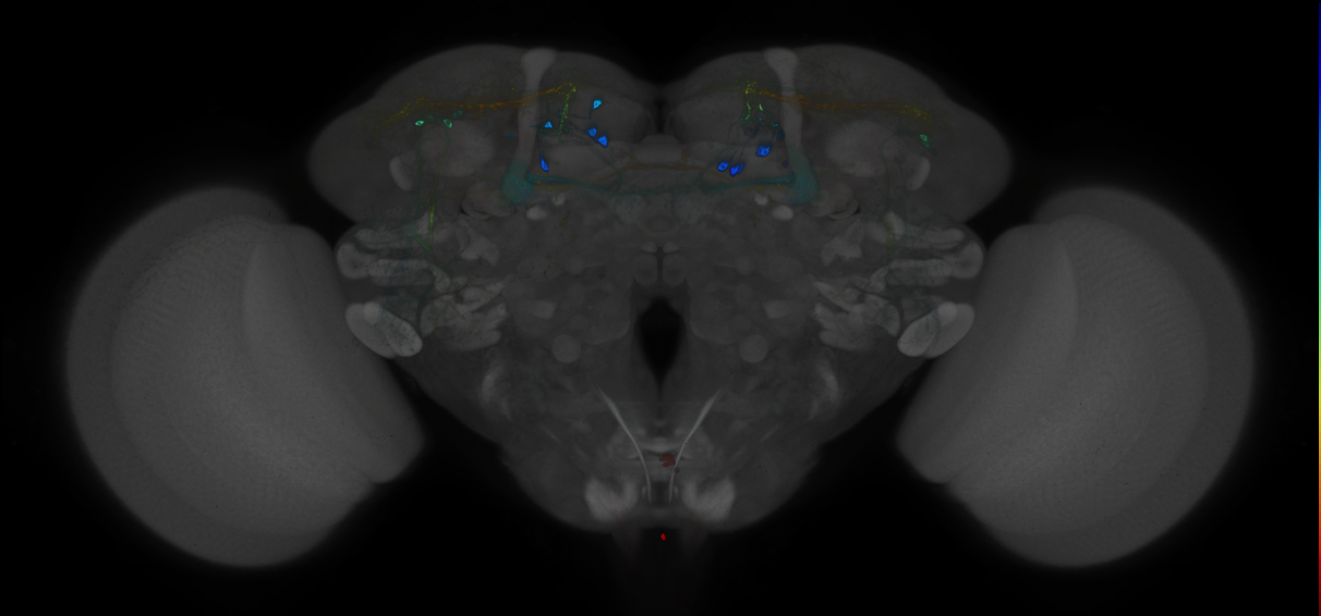JRC_MB299B_Brain_2014_20121212_32_D1_20x