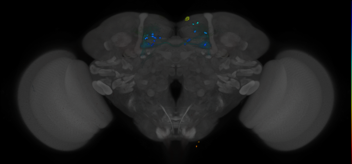 JRC_MB025B_Brain_2014_20121212_32_H2_20x