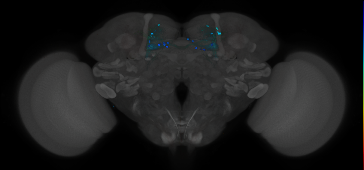 JRC_MB025B_Brain_2014_20121212_32_H3_20x