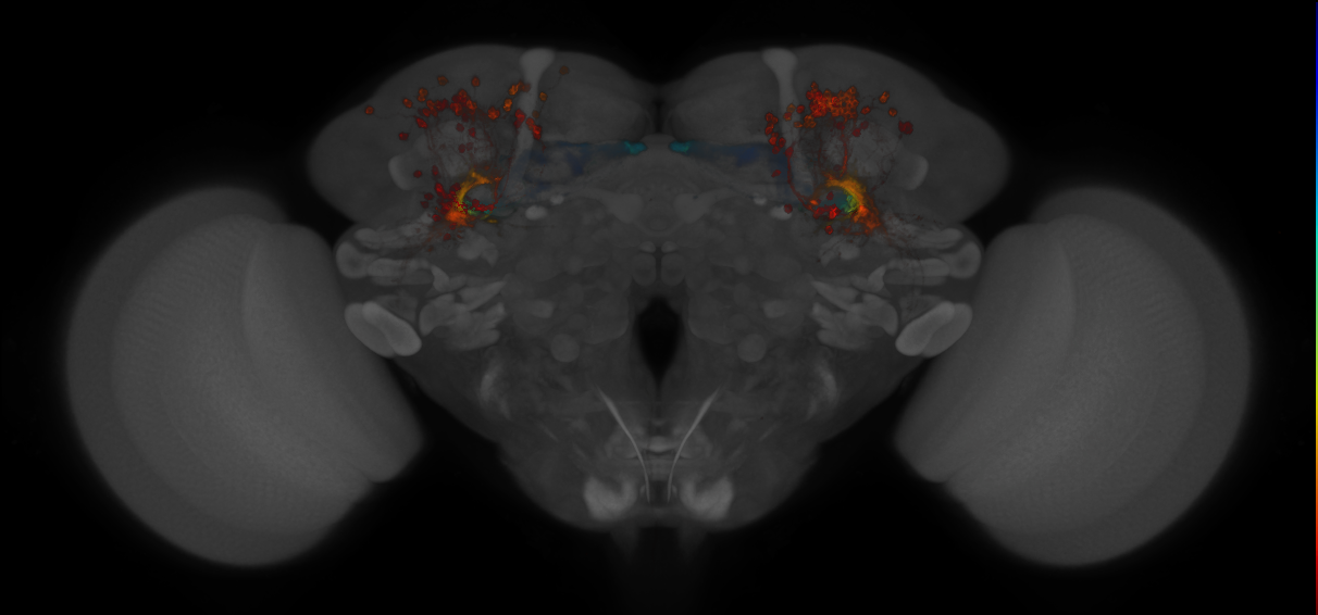 JRC_MB607B_Brain_2014_20130208_32_B2_20x