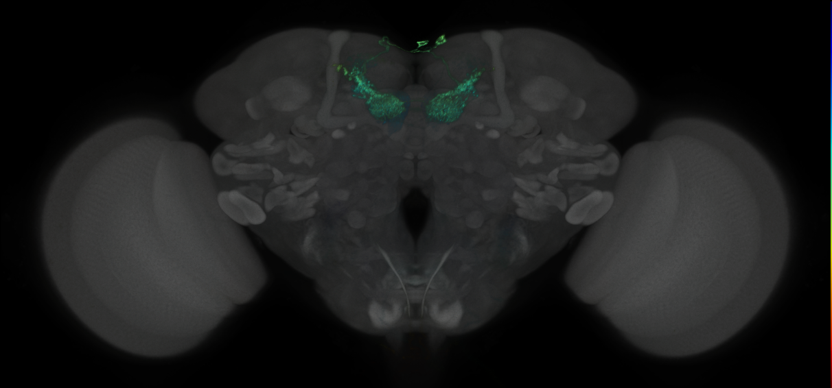 JRC_MB002B_Brain_2014_20121003_31_B3_20x