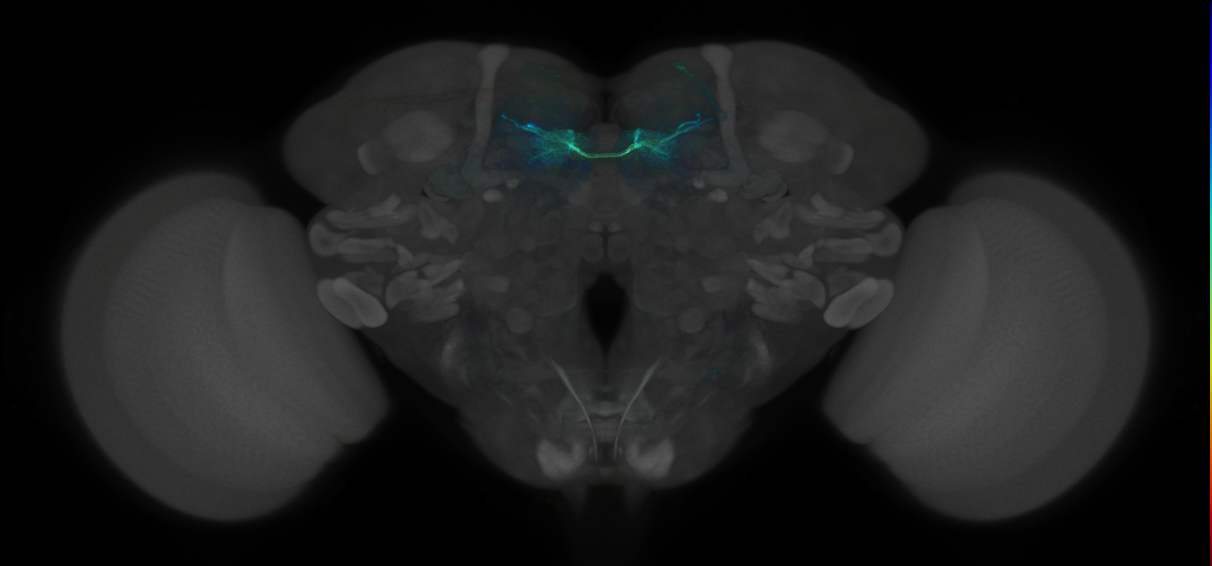 JRC_MB042B_Brain_2014_20121003_31_C1_20x