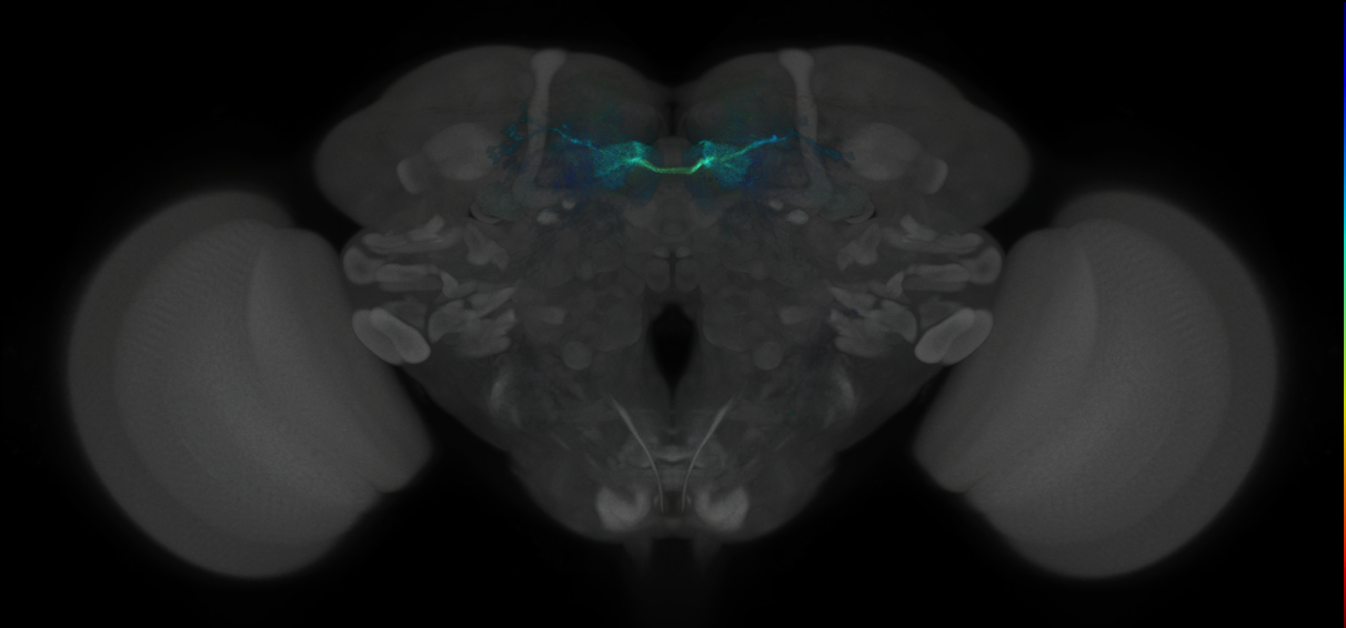 JRC_MB042B_Brain_2014_20121003_31_C3_20x