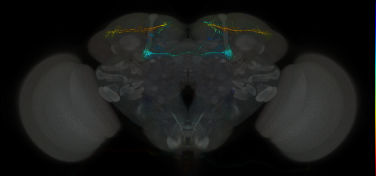 JRC_MB043B_Brain_2014_20121003_31_E1_20x