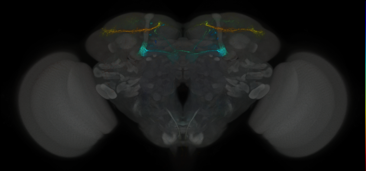 JRC_MB299B_Brain_2014_20121003_31_G1_20x