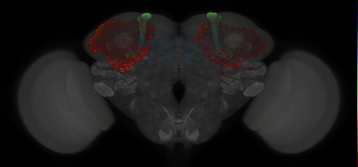 JRC_MB010B_Brain_2014_20121213_31_A3_20x