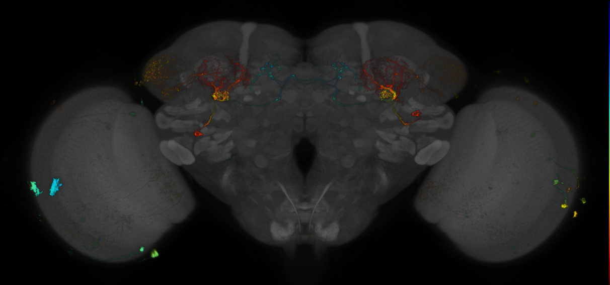 JRC_MB242A_Brain_2014_20130123_31_A1_20x