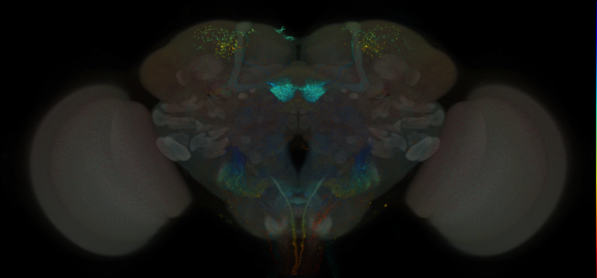 JRC_MB399B_Brain_2014_20121115_32_F3_20x
